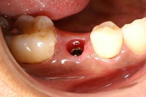 С мембраной или без?