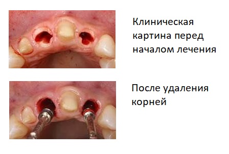 2.jpg 2.jpg