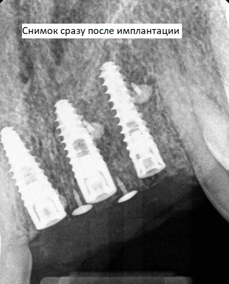 21.jpg 21.jpg